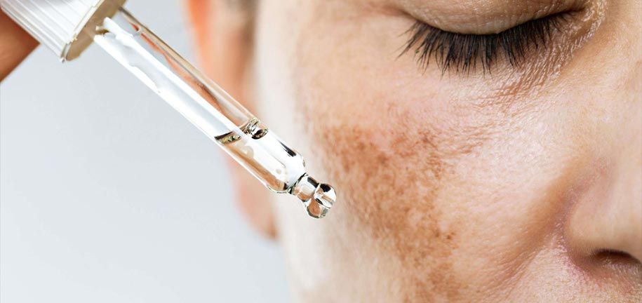 Wirksame Methoden zur Behandlung von Hyperpigmentierung