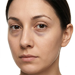Augenringe & Schwellungen Augenpflege