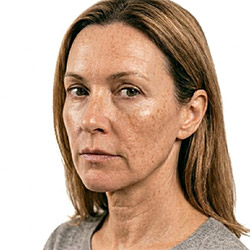Aufhellende Hautpflegeprodukte