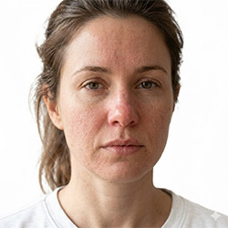 Pflege bei Trockenheit und Hautreizungen